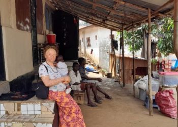 Mariatu Kamara, with her son, has undergone surgery twice due to skin condition common to persons with albinism. Image, Kemo Cham, ManoReporters.